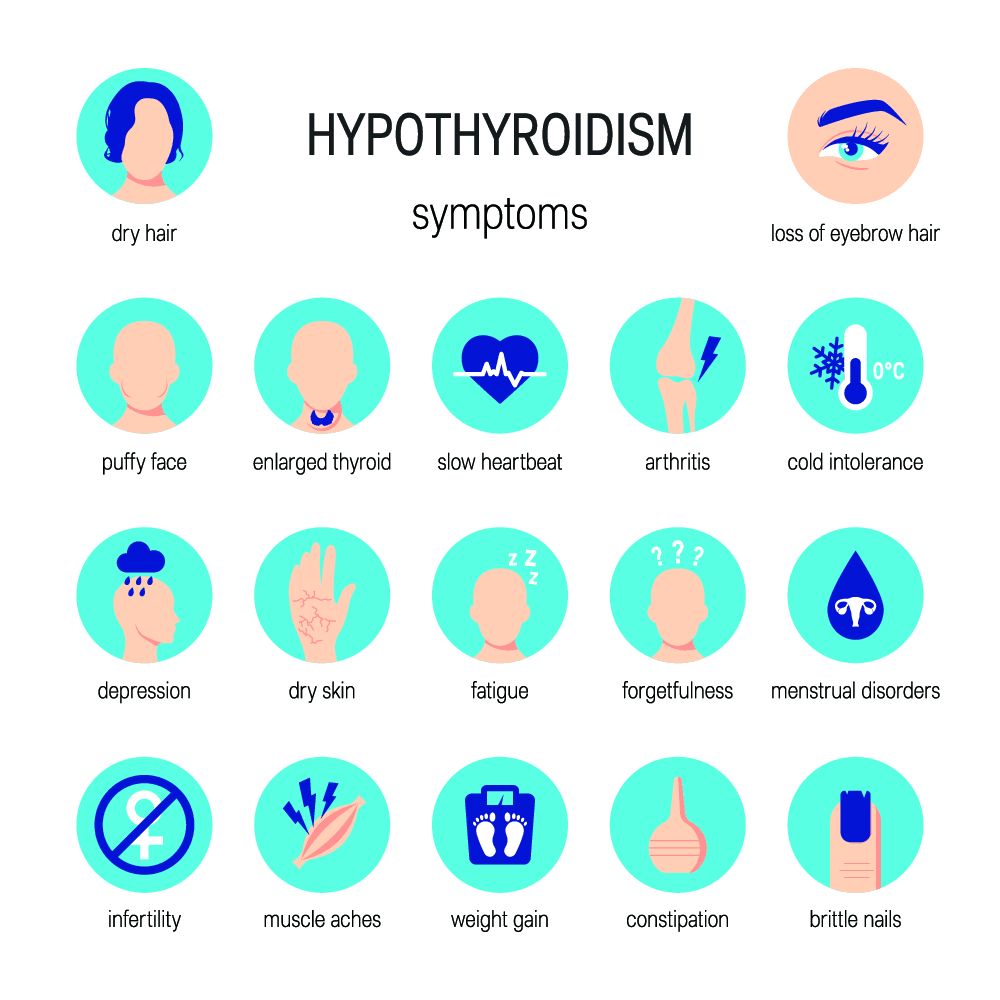 hypothyroidism infographic
